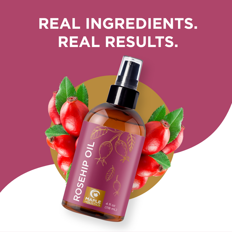 Rosehip Oil