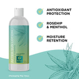 After Sun Lotion with Aloe Vera - Ultra Cooling Aloe Vera Lotion for Sunburn Hydration with Cocoa Butter & Rosehip Oil - Hydrating Aloe Lotion After Sun Moisturizer for Dry Skin with Hyaluronic Acid